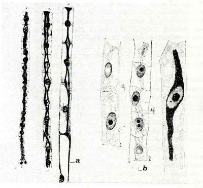 Le fibrille di Némec (a.) e le strutture osservate dalla Bambacioni (b.). [G. Mazzolani, 1978, p. 69]. 