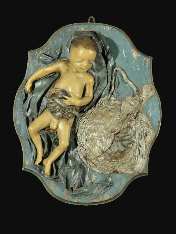 A. Morandi Manzolini, Feto con placenta, cera, Bologna, Museo di Palazzo Poggi